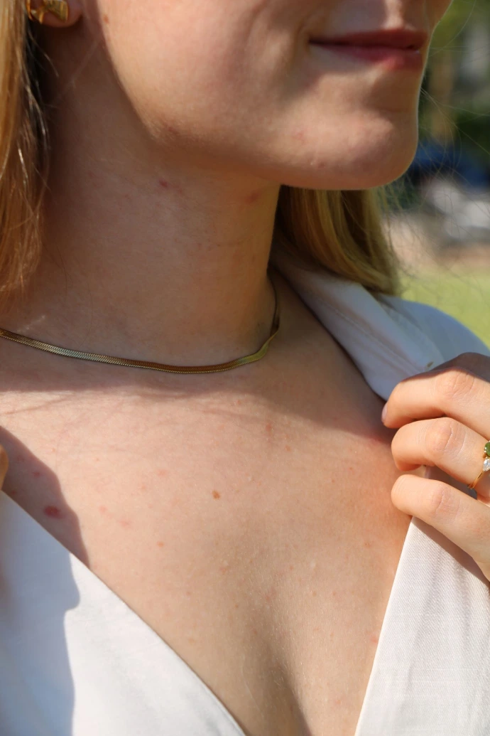 Image illustrante la peau d'une jeune femme